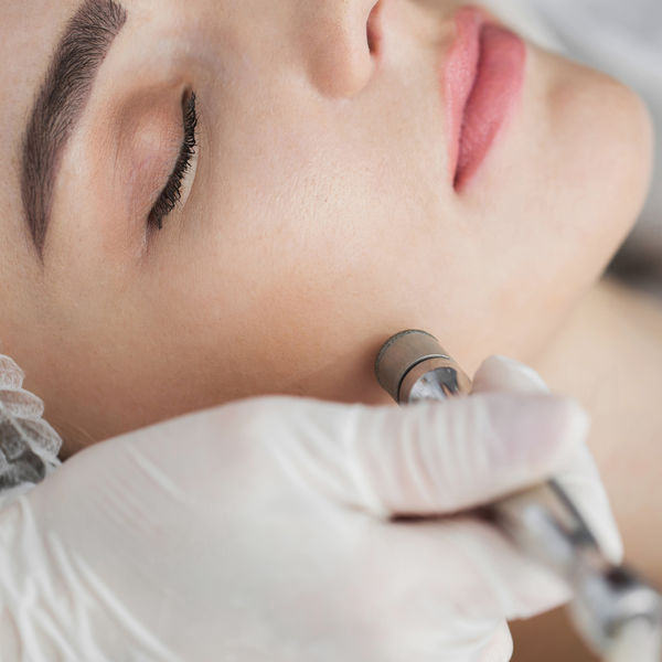 Microdermabrassion