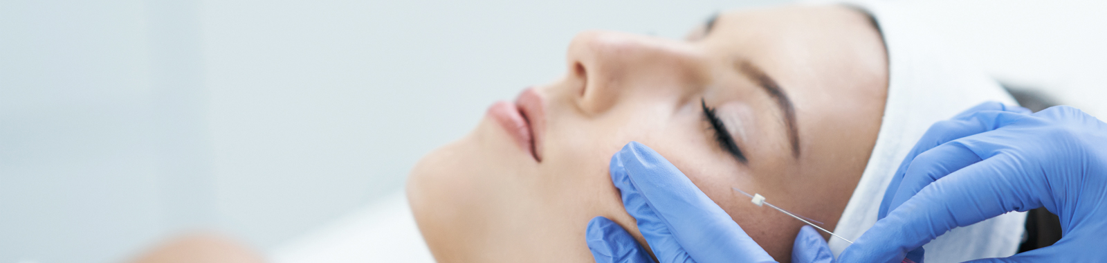 PDO Fadenlifting bei Aestheso
