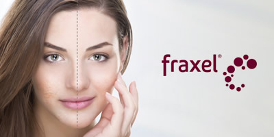 fraxellaser